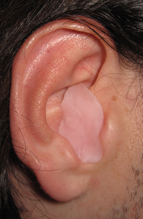 wax earplug